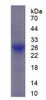 Cattle Recombinant Alpha-1-B-Glycoprotein (a1BG)