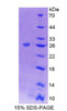 Mouse Recombinant B-Cell CLL/Lymphoma 9 (Bcl9)