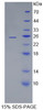 Human Recombinant Ubiquitin Conjugating Enzyme E2C (UBE2C)