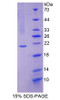 Human Recombinant Ubiquitin Conjugating Enzyme E2L3 (UBE2L3)