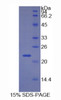 Human Recombinant Cyclin Dependent Kinase Inhibitor 1A (CDKN1A)