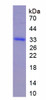 Rat Recombinant Interleukin 22 Receptor (IL22R)