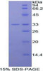 Mouse Recombinant Interleukin 20 Receptor Alpha (IL20Ra)