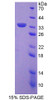 Human Recombinant Sirtuin 5 (SIRT5)