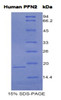 Human Recombinant Profilin 2 (PFN2)