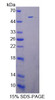 Mouse Recombinant Death Associated Protein Kinase 3 (DAPK3)