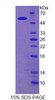 Human Recombinant Erythrocyte Membrane Protein Band 4.2 (EPB42)