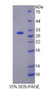 Human Recombinant Calcium Channel, Voltage Dependent, L-Type, Alpha 1S Subunit (CACNa1S)