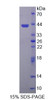 Human Recombinant Carbonyl Reductase 3 (CBR3)