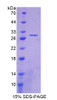 Mouse Recombinant Crystallin Beta A1 (CRYbA1)