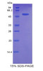Rat Recombinant Carnitine Palmitoyltransferase 1A, Liver (CPT1A)