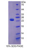 Human Recombinant Carnitine Palmitoyltransferase 1B, Muscle (CPT1B)