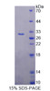 Human Recombinant Doublecortin Like Kinase 1 (DCLK1)