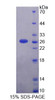 Human Recombinant Calcium Homeostasis Endoplasmic Reticulum Protein (CHERP)