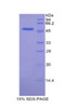 Mouse Recombinant Kinesin Family, Member 5A (KIF5A)