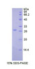 Human Recombinant Lysyl Oxidase Like Protein 2 (LOXL2)