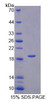 Human Recombinant Vesicle Associated Membrane Protein Associated Protein B (VAPB)