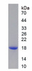 Human Recombinant Peroxiredoxin 2 (PRDX2)