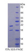 Human Recombinant Transient Receptor Potential Cation Channel Subfamily V, Member 6 (TRPV6)