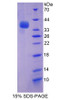 Human Recombinant Adaptor Related Protein Complex 2 Mu 1 (AP2m1)