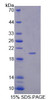 Human Recombinant Amyloid Beta Precursor Like Protein 1 (APLP1)