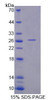 Human Recombinant Aspartate Beta Hydroxylase (ASPH)