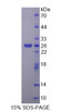 Rat Recombinant Nephroblastoma Overexpressed Gene (NOV)