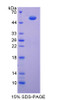 Rat Recombinant ATPase, H+ Transporting, Mitochondrial F1 Complex Beta Polypeptide (ATP5b)