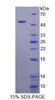 Rat Recombinant Transcobalamin II, Macrocytic Anemia (TCN2)