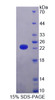 Human Recombinant Lysine Specific Demethylase 4A (KDM4A)