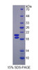 Rat Recombinant Uromodulin (UMOD)