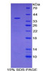 Human Recombinant Ubiquitin Carboxyl Terminal Hydrolase L5 (UCHL5)