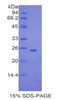 Mouse Recombinant Ubiquitin Carboxyl Terminal Hydrolase L5 (UCHL5)