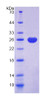 Rat Recombinant Ubiquitin Carboxyl Terminal Hydrolase L1 (UCHL1)