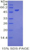 Mouse Recombinant Interferon Alpha 8 (IFNa8)