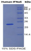 Human Recombinant Interferon Alpha 5 (IFNa5)