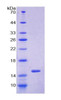 Human Recombinant Glutaredoxin (GLRX)