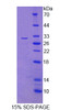 Human Recombinant Transformation/Transcription Domain Associated Protein (TRRAP)