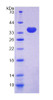 Human Recombinant Talin 2 (TLN2)