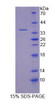 Human Recombinant Transketolase (TKT)