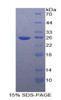 Human Recombinant Intercellular Adhesion Molecule 2 (ICAM2)