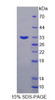 Human Recombinant Synaptotagmin Like Protein 2 (SYTL2)