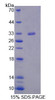 Mouse Recombinant Serine/Threonine Kinase 11 (STK11)