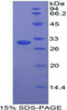 Human Recombinant STAM Binding Protein (STAMBP)