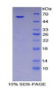 Mouse Recombinant Serine Peptidase Inhibitor Kazal Type 5 (SPINK5)
