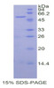 Human Recombinant Sialic Acid Acetylesterase (SIAE)