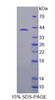 Human Recombinant SH3 Domain Binding Protein 2 (SH3BP2)