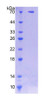 Human Recombinant N-Sulfoglucosamine Sulfohydrolase (SGSH)