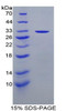 Mouse Recombinant Stratifin (SFN)