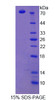 Rat Recombinant Scavenger Receptor Class B Member 1 (SCARB1)